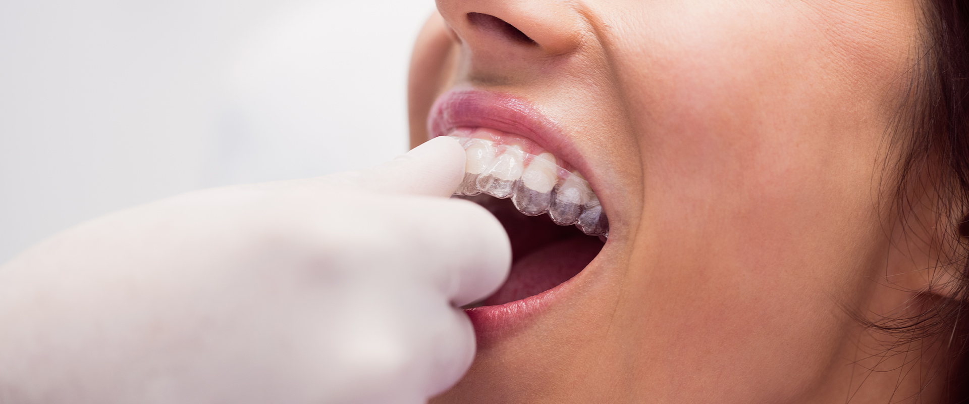 Hatay Ortodonti, Hatay Dörtyol Ortodonti, Hatay Ortodonti Uzmanı, Hatay Dörtyol Ortodonti Uzmanı, Hatay Çocuk Ortodontisi, Hatay Yetişkin Ortodontisi, Hatay Diş Teli Tedavisi, Hatay Şeffaf Plak, Hatay Invisalign, Hatay Dörtyol Çocuk Ortodontisi, Hatay Dörtyol Yetişkin Ortodontisi, Hatay Dörtyol Diş Teli Tedavisi, Hatay Dörtyol Şeffaf Plak, Hatay Dörtyol Invisalign