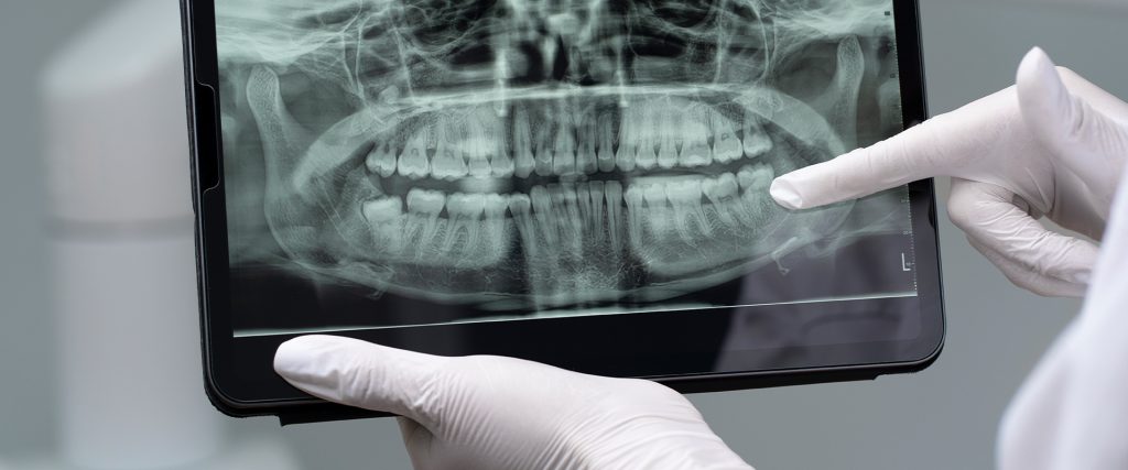 Hatay Ortodonti, Hatay Dörtyol Ortodonti, Hatay Ortodonti Uzmanı, Hatay Dörtyol Ortodonti Uzmanı, Hatay Çocuk Ortodontisi, Hatay Yetişkin Ortodontisi, Hatay Diş Teli Tedavisi, Hatay Şeffaf Plak, Hatay Invisalign, Hatay Dörtyol Çocuk Ortodontisi, Hatay Dörtyol Yetişkin Ortodontisi, Hatay Dörtyol Diş Teli Tedavisi, Hatay Dörtyol Şeffaf Plak, Hatay Dörtyol Invisalign