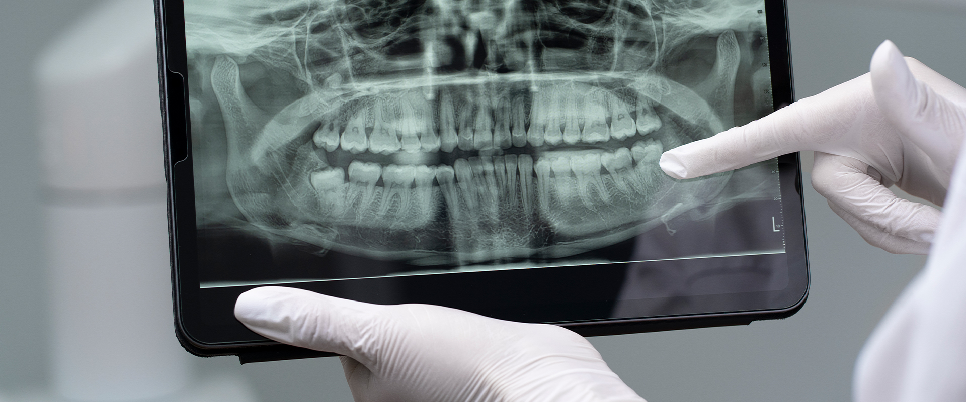 Hatay Ortodonti, Hatay Dörtyol Ortodonti, Hatay Ortodonti Uzmanı, Hatay Dörtyol Ortodonti Uzmanı, Hatay Çocuk Ortodontisi, Hatay Yetişkin Ortodontisi, Hatay Diş Teli Tedavisi, Hatay Şeffaf Plak, Hatay Invisalign, Hatay Dörtyol Çocuk Ortodontisi, Hatay Dörtyol Yetişkin Ortodontisi, Hatay Dörtyol Diş Teli Tedavisi, Hatay Dörtyol Şeffaf Plak, Hatay Dörtyol Invisalign